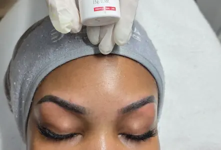 Chemical Peels and Dermaplaning
