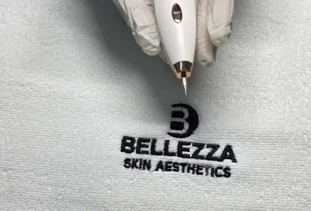 Skin Tag and Lesion Removal